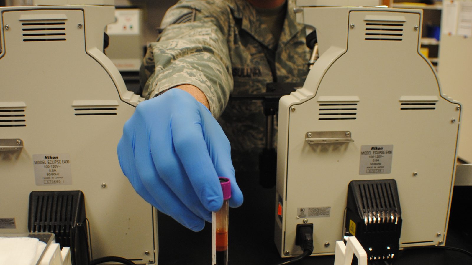 A generic photo of a subcutaneous injection syringe or laboratory blood sample tubes, with no identifiable person.